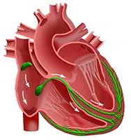 Форитон от стенокардии